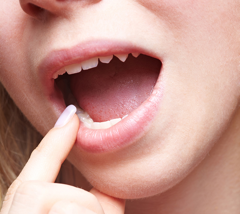 Some Wisdom About Wisdom Teeth